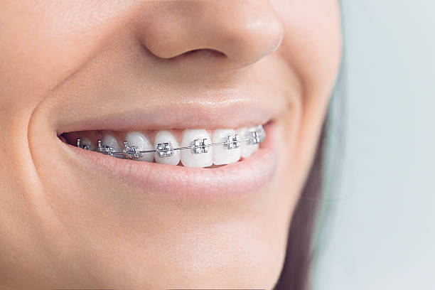 Best Wisdom Tooth Removal  in Addis, LA